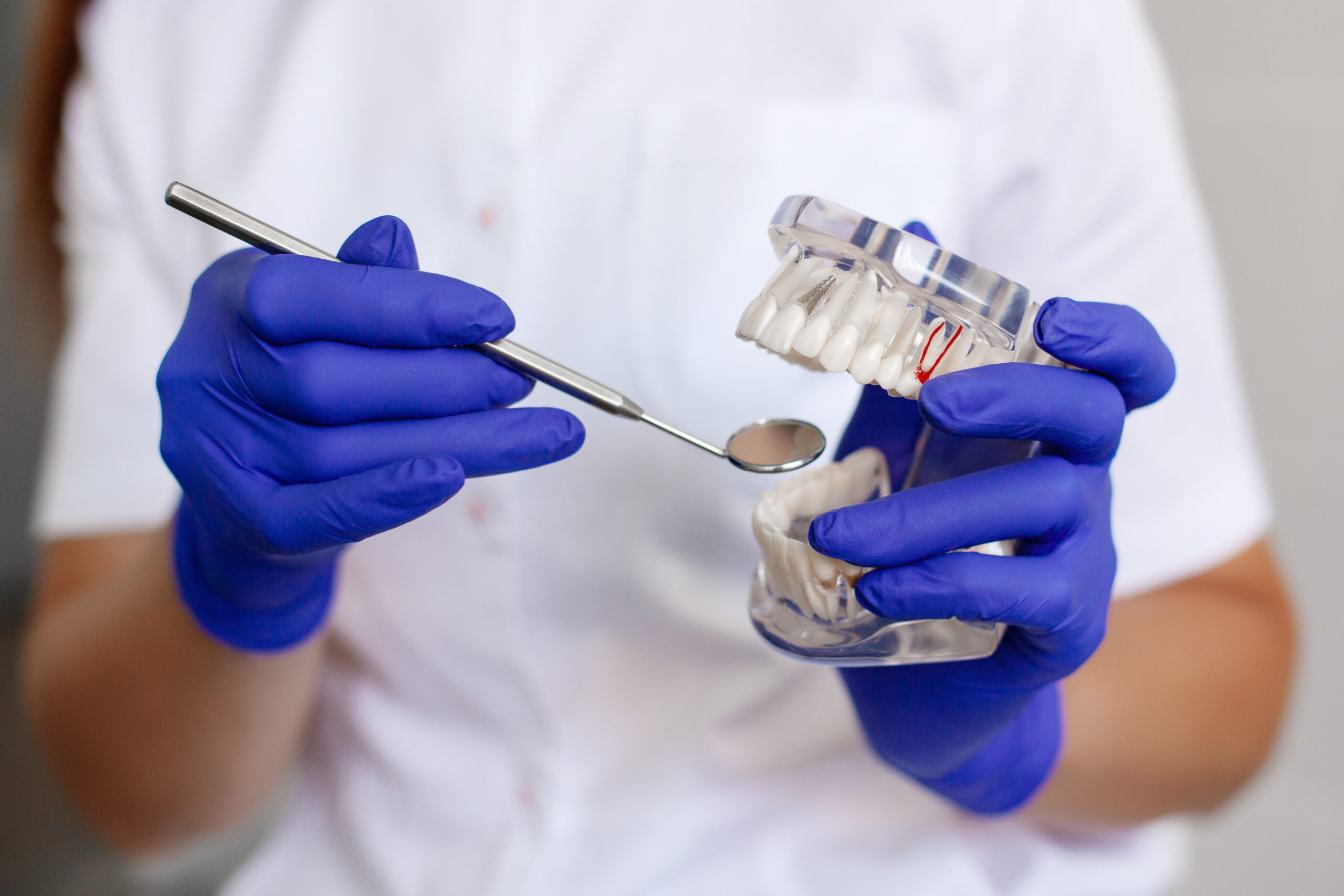 A dentist is holding a sample of jaw teeth in a dental office. A dentist is holding a sample of jaw teeth in a dental office. Close-up