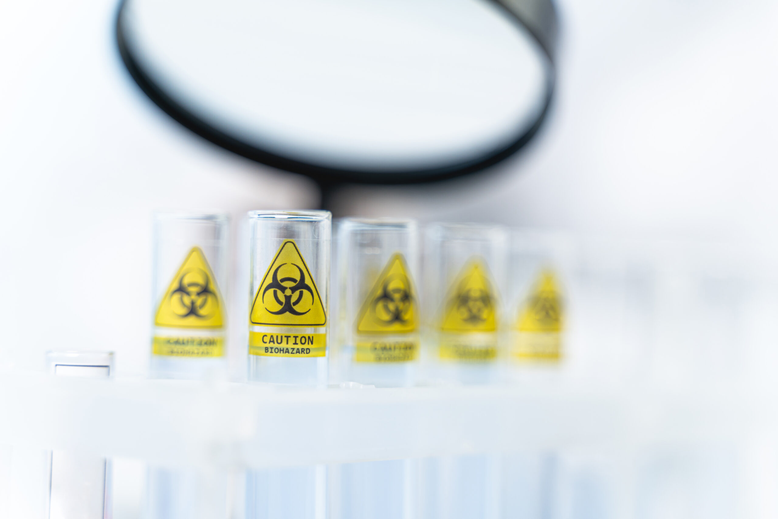 Close up of glass tubes that being on support Sign of danger. Stock photo of medical equipment in the laboratory for dangerous chemical experiments